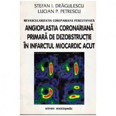 Stefan I. Dragulescu, Lucian P. Petrescu - Revascularizatia coronariana percutanata - Agioplastia coronariana primara de dezobst foto