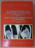 ABORDUL TRANSTORACIC AL ABDOMENULUI SUPERIOR SI RETROPERITONEULUI , CHIRURGIE DE GRANITA TORACO - ABDOMINALA , ATLAS BILINGV , ROMAN - ENGLEZ de ALEXA