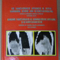 ABORDUL TRANSTORACIC AL ABDOMENULUI SUPERIOR SI RETROPERITONEULUI , CHIRURGIE DE GRANITA TORACO - ABDOMINALA , ATLAS BILINGV , ROMAN - ENGLEZ de ALEXA