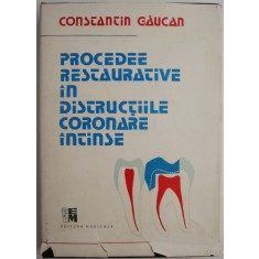 Procedee restaurative in distructiile coronare intinse &ndash; Constantin Gaucan (cu sublinieri)