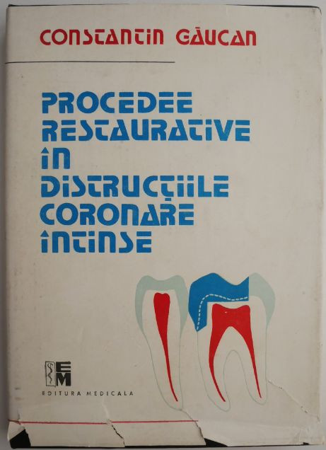Procedee restaurative in distructiile coronare intinse &ndash; Constantin Gaucan (cu sublinieri)
