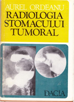 AS - AUREL ORDEANU - RADIOLOGIA STOMACULUI TUMORAL foto