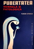Pubertatea, normala si patologica - Tudor Stoica