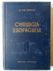 &amp;quot;CHIRURGIA ESOFAGULUI&amp;quot;, Dr. Dan Gavriliu, 1957 foto