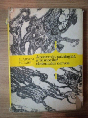 ANATOMIA PATOLOGICA A TUMORILOR SISTEMULUI NERVOS de C. ARSENI , N. CARP , 1978 foto