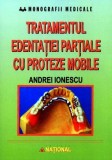 Tratamentul edenta&Egrave;iei par&Egrave;iale cu proteze mobile - Paperback brosat - Andrei Ionescu - Na&Aring;&pound;ional