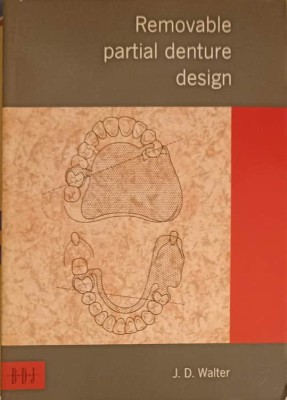 REMOVABLE PARTIAL DENTURE DESIGN-J.D. WALTER-253001 foto