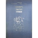 I. Chiricuta - Cancerul colului uterin (Editia: 1972)