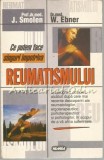 Ce Putem Face Singuri Impotriva Reumatismului - J. Smolen, W. Ebner - Remedii Naturale, Medicina Alternativa, Reumatologie - Nemira