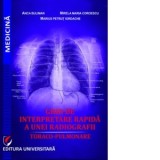 Ghid de interpretare rapida a unei radiografii toraco-pulmonare - Anca Buliman, Mirela Maria Coroescu, Marius Petrut Iordache