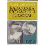 Aurel Ordeanu - Radiologia stomacului tumoral - 126669
