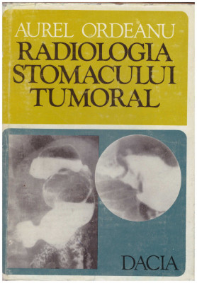 Aurel Ordeanu - Radiologia stomacului tumoral - 126669 foto