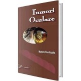 Tumori oculare - Marieta Dumitrache