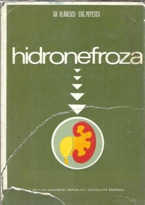 Hidronefroza - Gh. Olanescu foto
