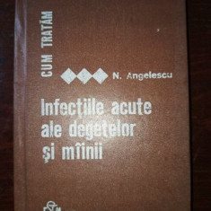 Cum tratam infectiile acute ale degetelor si mainii- N.Angelescu