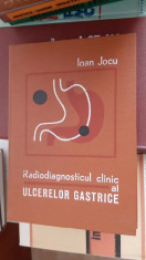 RADIODIAGNOSTICUL CLINIC AL ULCERELOR GASTRICE IOAN JOCU STARE FOARTE BUNA . foto