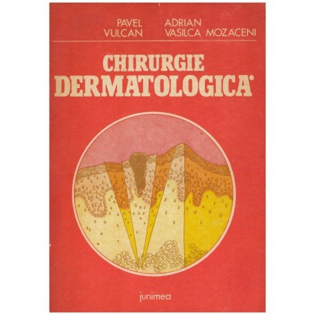 Pavel Vulcan, Adrian Vasilica Mozaceni - Chirurgie dermatologica - 124005