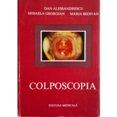 Colposcopia &ndash; Dan Alessandrescu