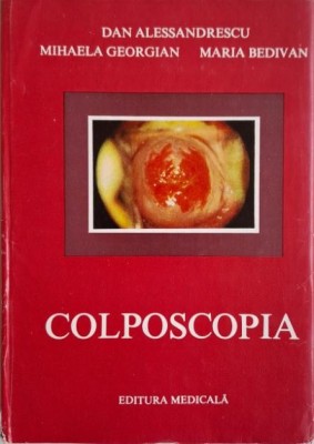 Colposcopia &amp;ndash; Dan Alessandrescu foto