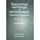 Rodica Dutu - Diagnosticul morfologic al carcinoamelor (Editia: 1985)