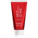 MEDIBLANC Whitening pastă pentru albire, cu hidroxiapatită 50 ml