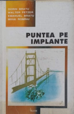 PUNTEA DE IMPLANTE-DORIN BRATU, WALTER FETZER, EMANUEL BRATU, MIHAI ROMINU foto