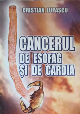 CANCERUL DE ESOFAG SI DE CARDIA-CRISTIAN LUPASCU foto