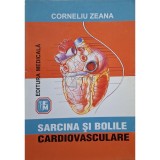 Corneliu Zanea - Sarcina si bolile cardiovasculare (Editia: 2002)