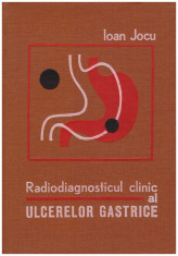 Radiodiagnosticul clinic al ulcerelor gastrice foto