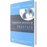 Diagnosticul cancerului de prostata - Valentin Ambert