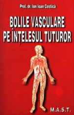 Bolile vasculare pe in?elesul tuturor foto