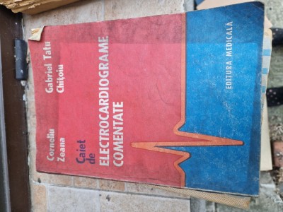 Electrocardiograme comentate vintage foto