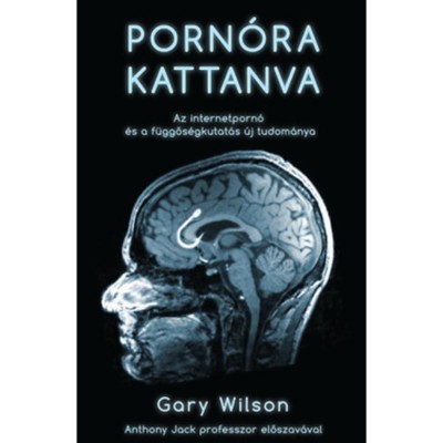 Porn&amp;oacute;ra kattanva - Az internetporn&amp;oacute; &amp;eacute;s a f&amp;uuml;ggős&amp;eacute;gkutat&amp;aacute;s &amp;uacute;j tudom&amp;aacute;nya - Gary Wilson foto