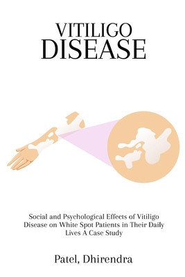 Social and Psychological Effects of Vitiligo Disease on White Spot Patients in Their Daily Lives A Case Study foto