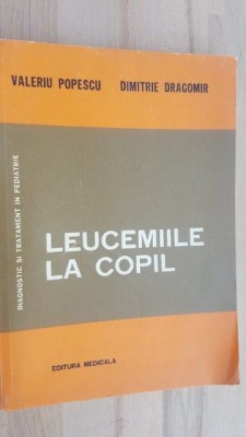 Leucemiile la copil- Valeriu Popescu, Dimitrie Dragomir foto