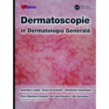 Dermatoscopie in Dermatologia Generala - Aimilios Lallas, Enzo Errichetti, Dimitrios Ioannides