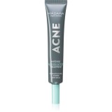 M&aacute;dara Acne tratament topic pentru acnee 20 ml