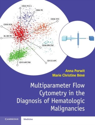 Multiparameter Flow Cytometry in the Diagnosis of Hematologic Malignancies foto