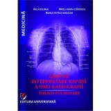 Ghid de interpretare rapida a unei radiografii toraco-pulmonare - Anca Buliman