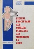 Leziuni Fracturare Ale Oaselor Diafizare Ale Membrelor La Cop - Leonida Cristu Ionescu , D712, Medicala