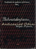 Cumpara ieftin Electrocardiograma - Georgeta Scripcaru, Iasi 1978, Medicina, 311 pagini