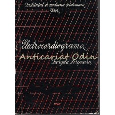 Electrocardiograma - Georgeta Scripcaru