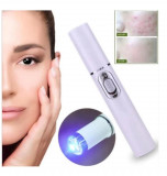 Cumpara ieftin Dispozitiv cu lumina laser pentru tratament facial, GMO, 7910E, alb