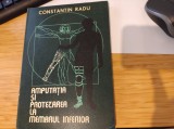 Amputația și protezarea la membrul inferior. Constantin Radu
