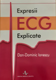 Expresii ECG explicate