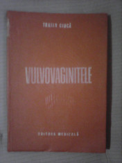 Vulvovaginitele - TRAIAN CIUCA foto