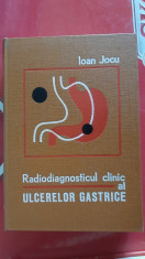 Radiodiagnosticul Clinic Al Ulcerelor Gastrice - Ioan Jocu STARE FOARTE BUNA . foto