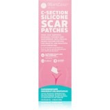 MomCare by Lina C-Section Silicone Scar Patches plasturi de silicon pentru cicatrici de cezariană mărime L-XL 5 x 20 cm 3 buc