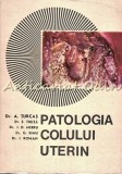 Patologia Colului Uterin - A. Turcas, E. Truta, D. Merfu, Ed. Dacia 1971, Medicina Ginecologie, 342 pagini