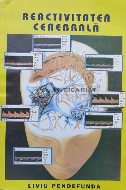 Reactivitatea cerebrala si transcranial doppler - 1994 - Liviu Pendefunda ($L150)
